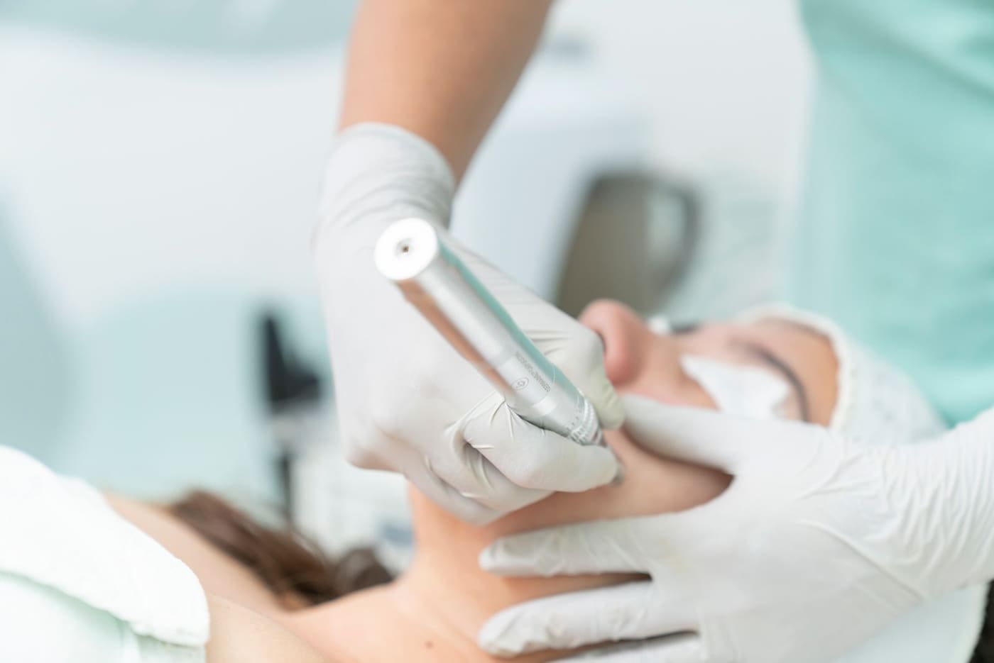 Profissional aplicando microagulhamento facial com dermapen